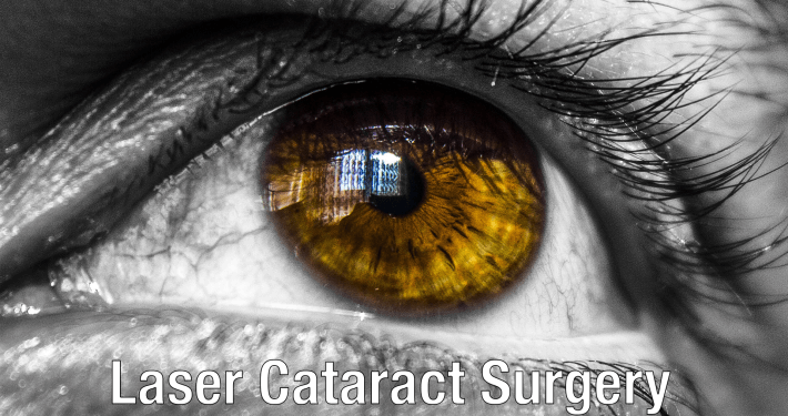 Acrysof Iq Vivity Cataract Lens Texas Eye Surgeons