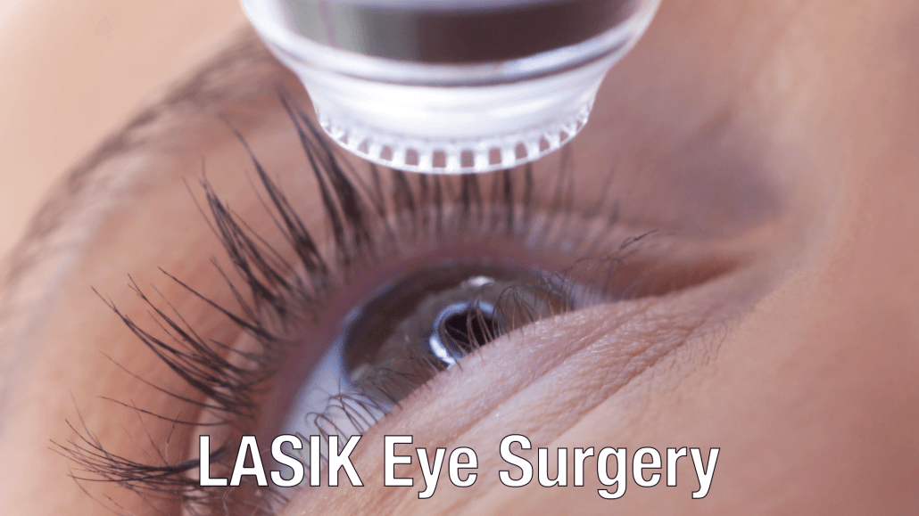 LASIK Eye Surgery Serving Plano Dallas Fort Worth - LASIK